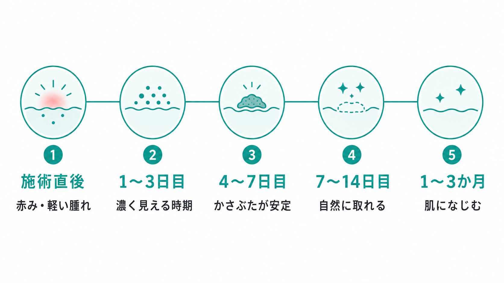 シミ取りレーザーの日数別の経過