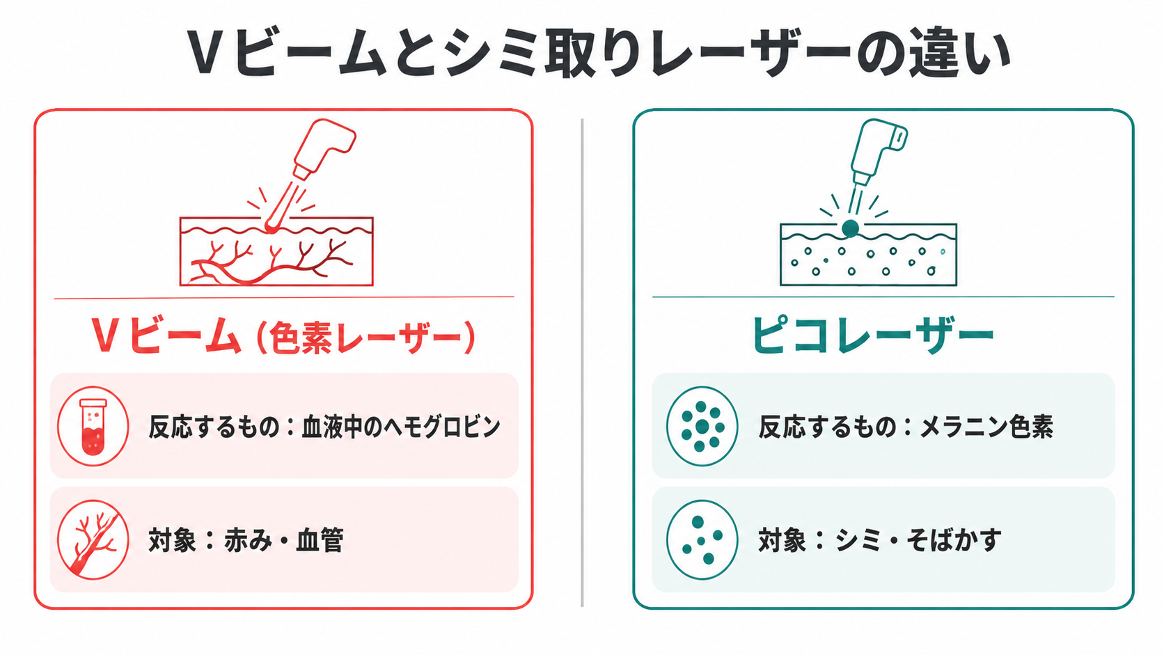 Vビームとシミ取りレーザーの違い
